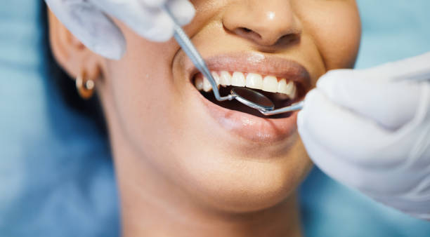 Best Emergency Cosmetic Dentistry (e.g., broken veneers) in Abingdon, VA